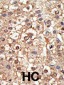 PIASy Antibody (N-term)